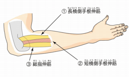 短橈側手根伸筋、長橈側手根伸筋、総指伸筋のイラスト
