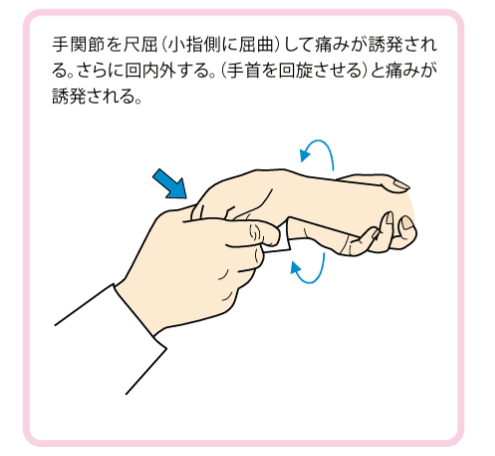 TFCCで手関節尺屈時の痛みのイラスト