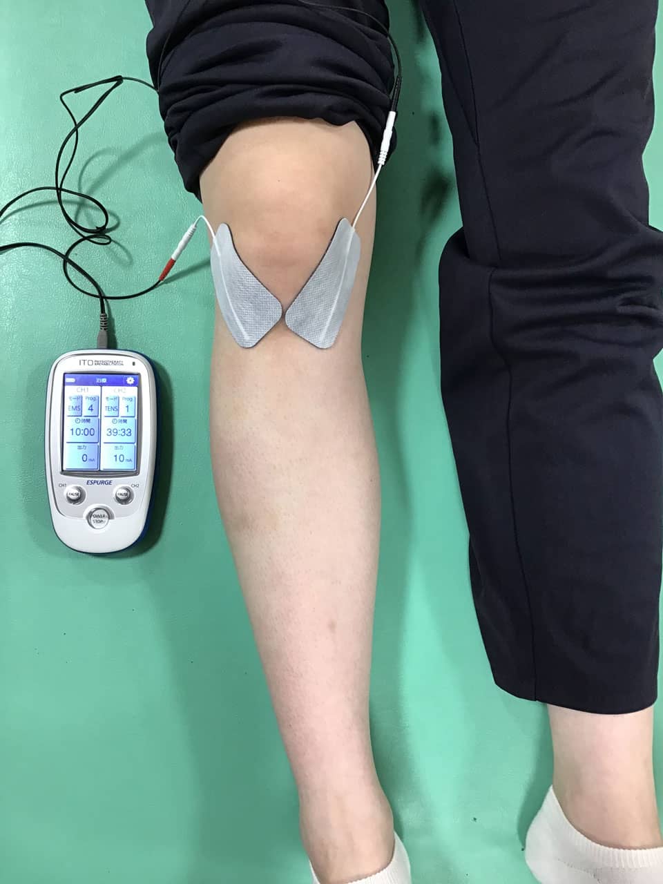 TENSを使用した治療の様子