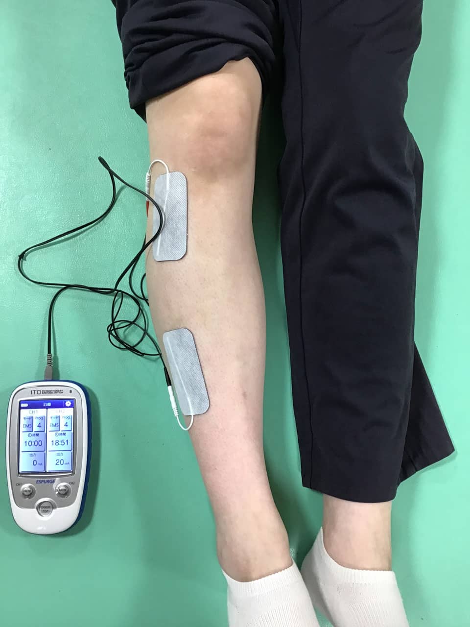 ENSを使用した治療の様子