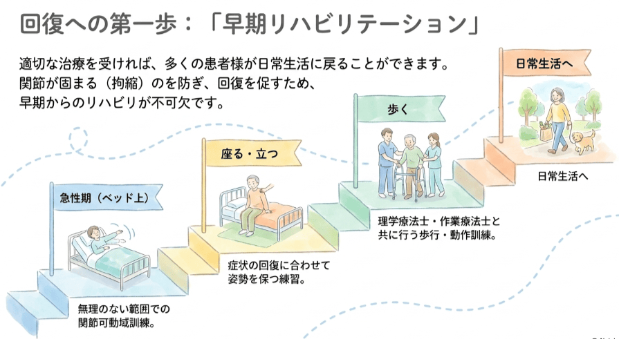 ギラン・バレー症候群におけるリハビリテーション段階のイラスト
