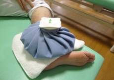 足関節骨折の手術後のリハビリテーションについて