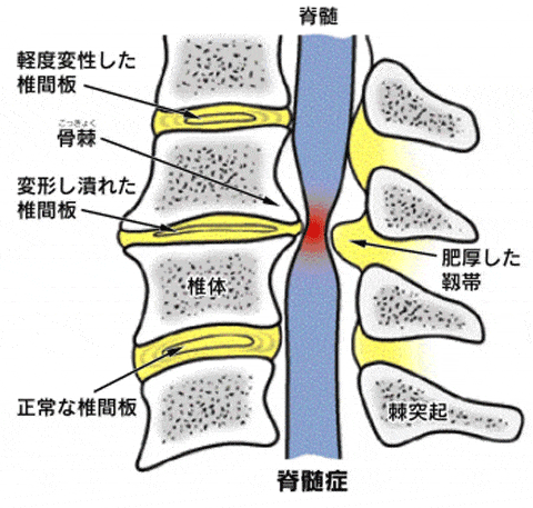 頚椎側面のイラスト
