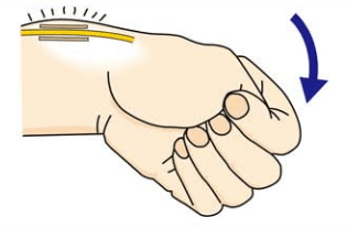 ドケルバン病診断のため、親指を握りこぶしの中に入れて手首を小指側に曲げるイラスト