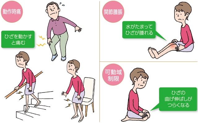 医師の診察を受ける時期