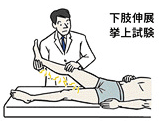 腰椎椎間板ヘルニアでの下肢伸展挙上試験のイラスト