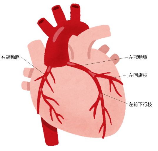 冠動脈を説明する心臓のイラスト