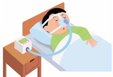 CPAPを装着して寝る男性のイラスト