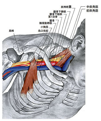 頚椎から手へとつながる神経の束や血管のイラスト